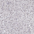 Anti-ZNF532 Antibody