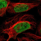 Immunofluorescent staining of human cell line U-2 OS shows localization to nucleoplasm.