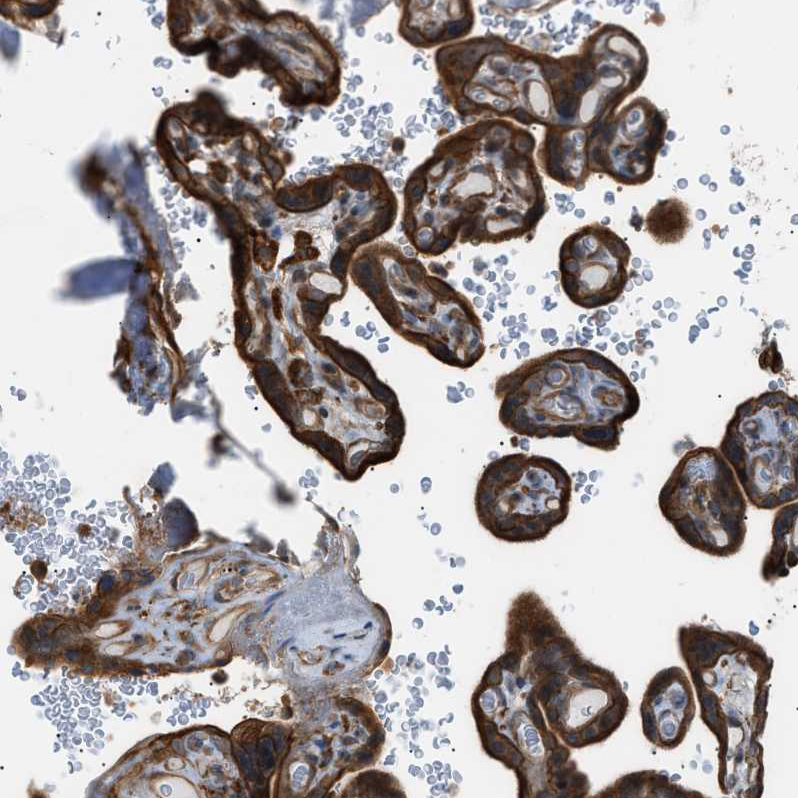 Anti-DYRK1A Antibody