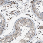Immunohistochemical staining of human testis shows weak to moderate cytoplasmic positivity in cells in seminiferous ducts.