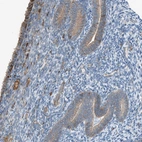 Immunohistochemical staining of human endometrium shows weak to moderate cytoplasmic positivity in glandular cells.