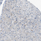 Immunohistochemical staining of human liver shows no positivity in hepatocytes as expected.