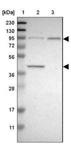 Lane 1: Marker [kDa] 230, 130, 95, 72, 56, 36, 28, 17, 11_br/_Lane 2: Human cell line RT-4_br/_Lane 3: Human cell line U-251MG sp