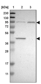 Lane 1: Marker [kDa] 230, 130, 95, 72, 56, 36, 28, 17, 11_br/_Lane 2: Human cell line RT-4_br/_Lane 3: Human cell line U-251MG sp