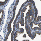 Immunohistochemical staining of human fallopian tube shows moderate to strong cytoplasmic positivity in glandular cells.