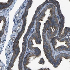 Immunohistochemical staining of human fallopian tube shows moderate to strong cytoplasmic positivity in glandular cells.