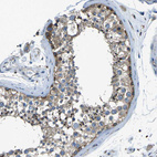 Immunohistochemical staining of human testis shows moderate to strong cytoplasmic positivity in cells in seminiferous ducts.