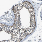 Immunohistochemical staining of human testis shows moderate to strong cytoplasmic positivity in cells in seminiferous ducts.