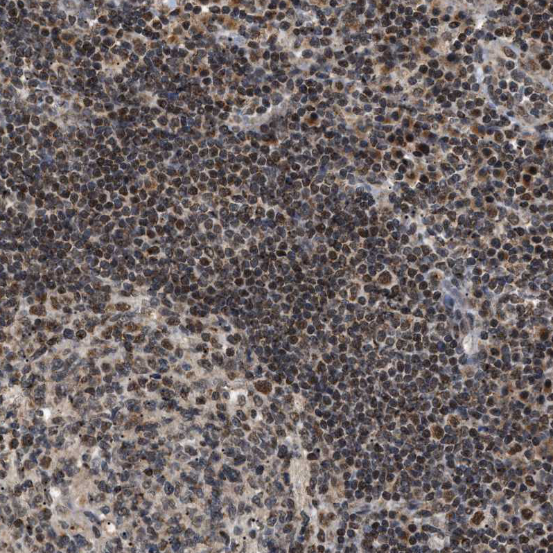 Anti-ZBTB11 Antibody