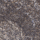 Anti-ZBTB11 Antibody