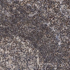 Anti-ZBTB11 Antibody