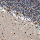 Immunohistochemical staining of human Cerebellum shows moderate nuclear positivity in Purkinje and glial cells.