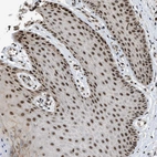 Immunohistochemical staining of human Skin shows moderate nuclear positivity in squamous epithelial cells.