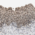 Immunohistochemical staining of human Urinary bladder shows moderate nuclear positivity in urothelial cells.