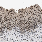 Immunohistochemical staining of human Urinary bladder shows moderate nuclear positivity in urothelial cells.