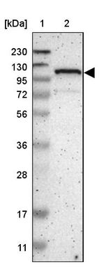 Lane 1: Marker [kDa] 230, 130, 95, 72, 56, 36, 28, 17, 11_br/_Lane 2: Human cell line RT-4