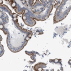 Anti-SFXN5 Antibody