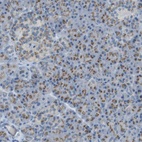 Anti-TXNDC15 Antibody