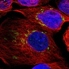Immunofluorescent staining of human cell line A-431 shows localization to the Golgi apparatus.