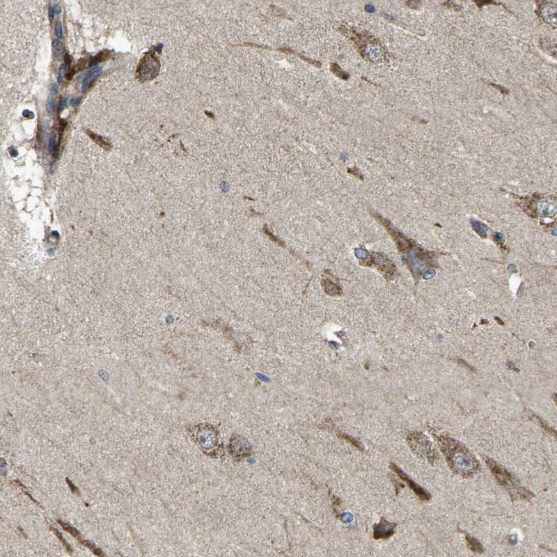 Anti-B4GAT1 Antibody