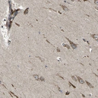 Anti-B4GAT1 Antibody