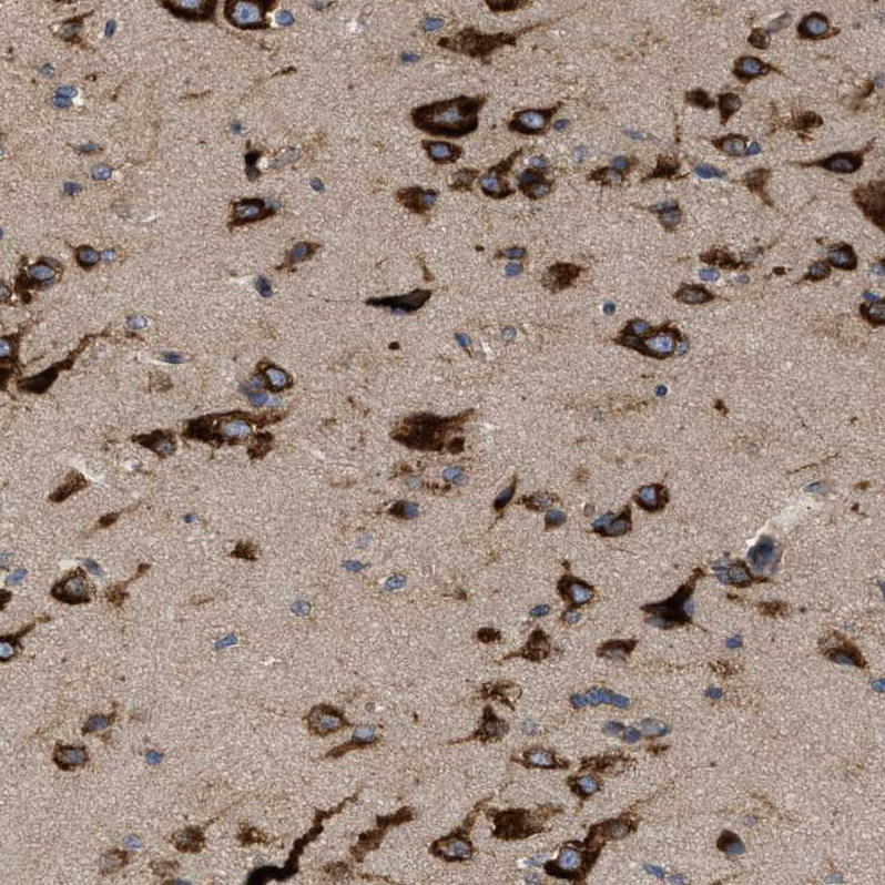 Anti-IL1RL2 Antibody