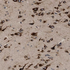 Anti-IL1RL2 Antibody