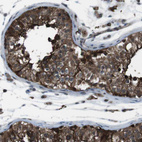 Immunohistochemical staining of human testis shows strong cytoplasmic positivity in cells in seminiferous ducts.