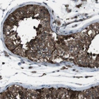 Immunohistochemical staining of human testis shows strong cytoplasmic positivity in cells in seminiferous ducts.
