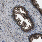 Immunohistochemical staining of human prostate shows strong cytoplasmic positivity in glandular cells.