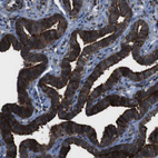 Immunohistochemical staining of human fallopian tube shows strong cytoplasmic positivity in glandular cells.