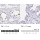Anti-EQTN Antibody