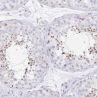 Immunohistochemical staining of human testis shows moderate membranous positivity in cells in seminiferous ducts.