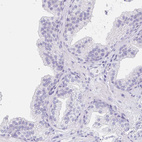 Immunohistochemical staining of human prostate shows no positivity in glandular cells as expected.