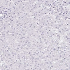Immunohistochemical staining of human liver shows no positivity in hepatocytes as expected.