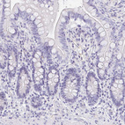 Immunohistochemical staining of human colon shows no positivity in glandular cells as expected.