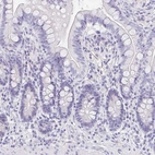 Immunohistochemical staining of human colon shows no positivity in glandular cells as expected.