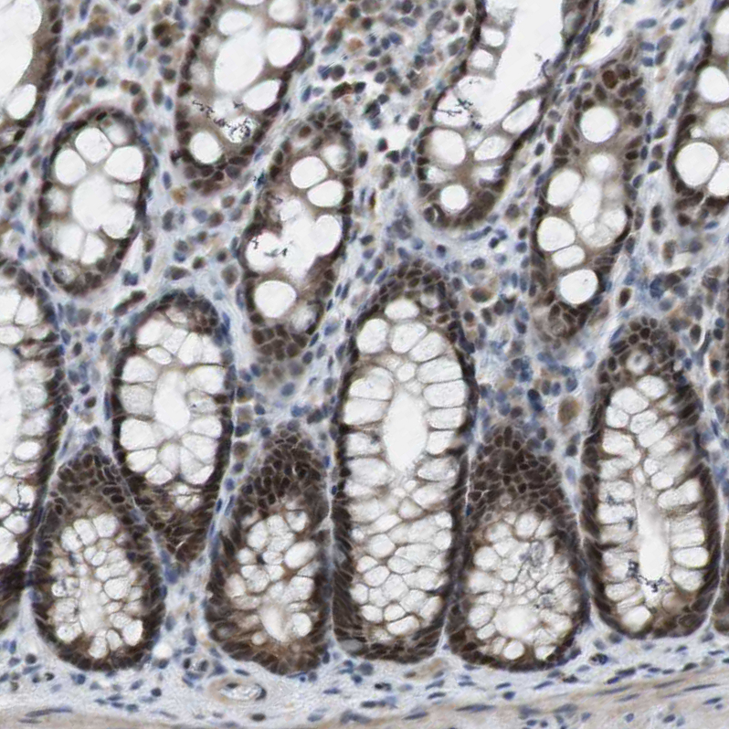 Anti-MAPKAPK5 Antibody