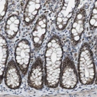 Anti-MAPKAPK5 Antibody
