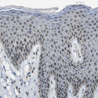 Immunohistochemical staining of human skin shows moderate nuclear positivity in squamous epithelial cells.