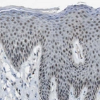 Immunohistochemical staining of human skin shows moderate nuclear positivity in squamous epithelial cells.