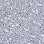 Immunohistochemical staining of human liver shows no positivity in hepatocytes as expected.