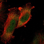 Immunofluorescent staining of human cell line U-251 MG shows localization to nucleoplasm & cytosol.