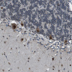 Immunohistochemical staining of human cerebellum shows strong nuclear and cytoplasmic positivity in Purkinje cells.