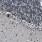 Immunohistochemical staining of human cerebellum shows strong nuclear and cytoplasmic positivity in Purkinje cells.
