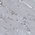 Immunohistochemical staining of human skeletal muscle shows moderate nuclear positivity in subset of myocytes.