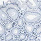 Immunohistochemical staining of human stomach shows no positivity in glandular cells as expected.