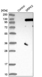 Western blot analysis in control (vector only transfected HEK293T lysate) and SRPK2 over-expression lysate (Co-expressed with a C-terminal myc-DDK tag (~3.1 kDa) in mammalian HEK293T cells, LY403641).