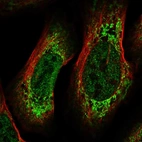 Anti-CREB3L2 Antibody