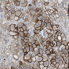 Anti-TYW1 Antibody